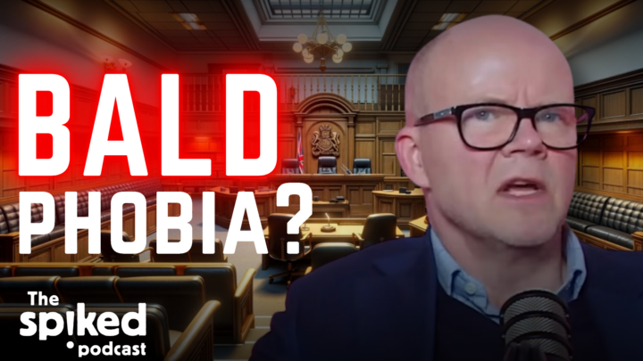 Is it sexist to call a man ‘bald’?