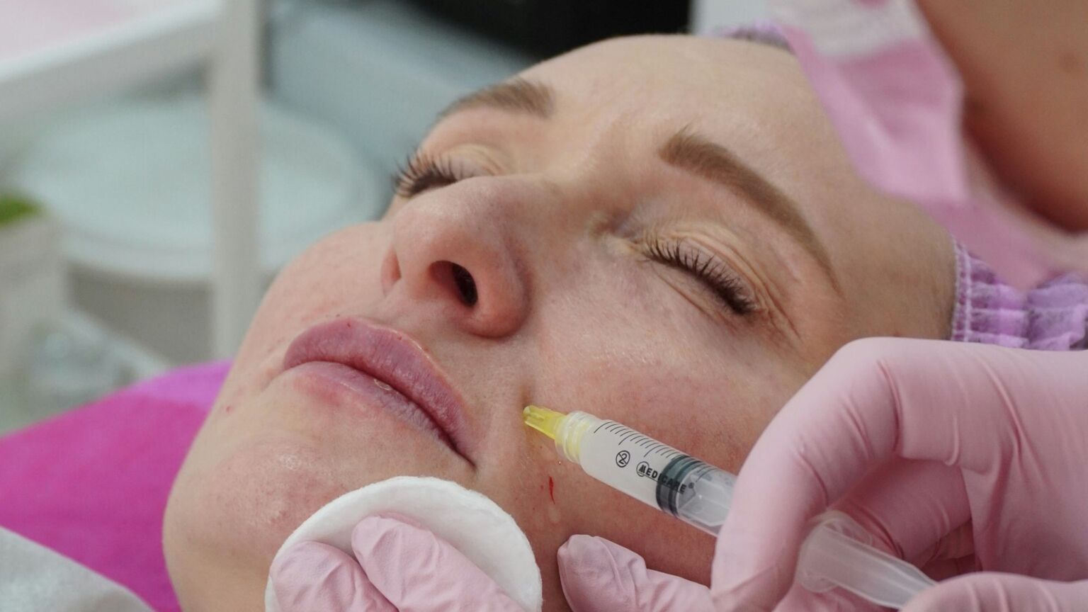 The ugly truth about botox